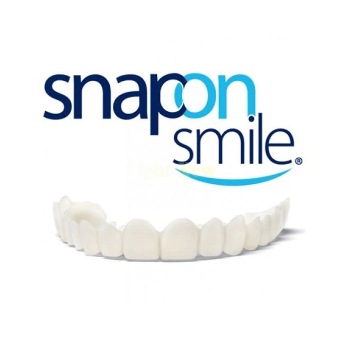 Snap-On Smile - veneer